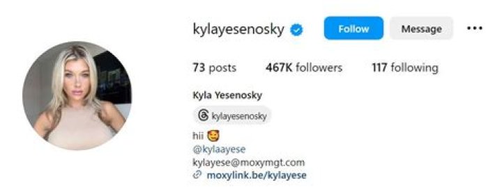 Breaking News: Kyla Yesenosky's Private Data Leaked