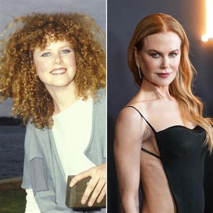 Did Nicole Kidman's Face Get Work Done? The Truth About Plastic Surgery