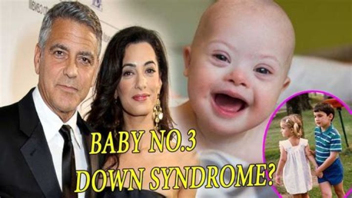 Does One Of George Clooney's Twins Have Down Syndrome?