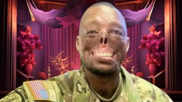 Randy Adams Face Accident: A Harrowing Experience