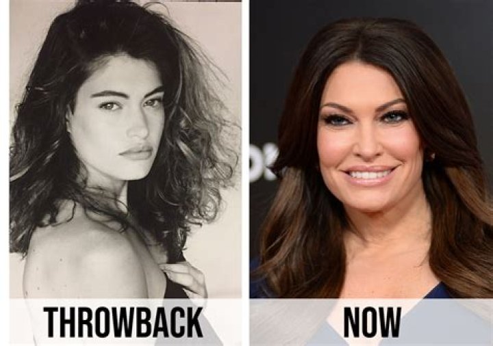 The Curious Case Of Kimberly Guilfoyle's Face Transformation