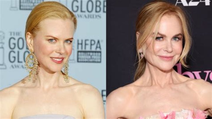 The Truth About Nicole Kidman's Plastic Surgery Speculations