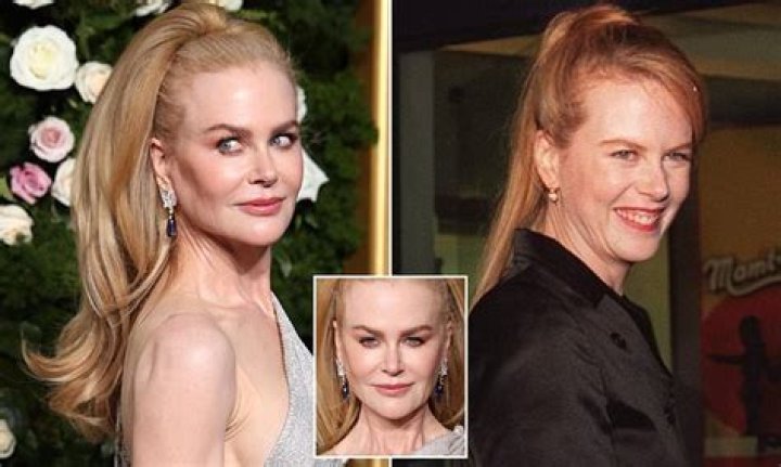The Ultimate Guide To Nicole Kidman's Surgeries: Facts, Rumors, And Expert Insights