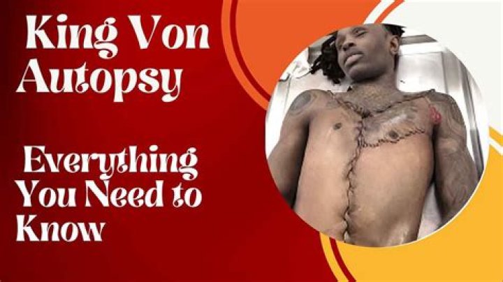 Unraveling The King Von Autopsy Report: Detailed Findings And Implications